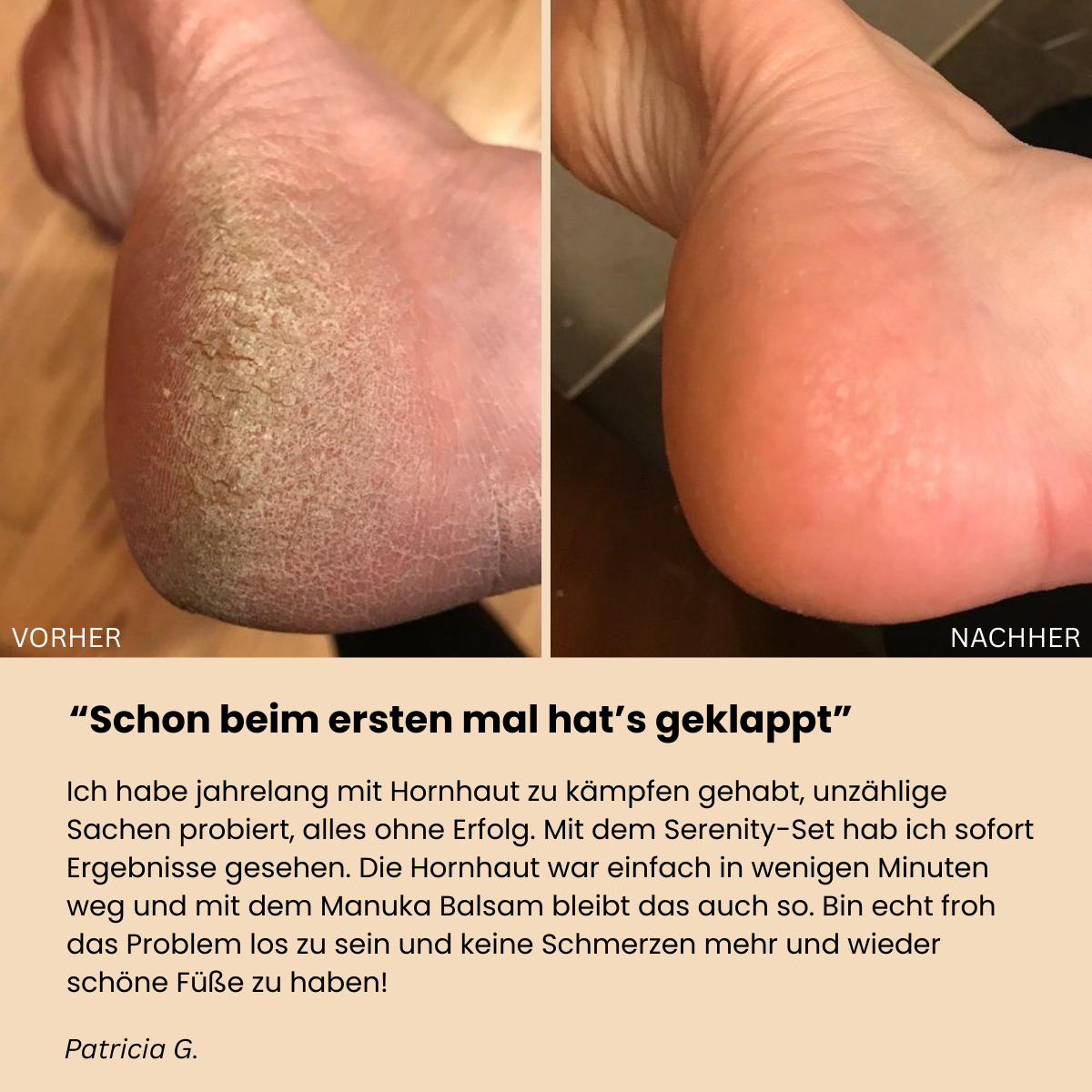 Luruvi Serenity Set™ - Für babyweiche Füße!