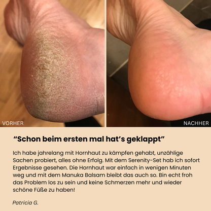 Elaimei Manuka Honig Balsam